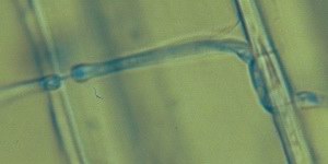 Bl�uepilz: junge Bohrhyphen im Holz